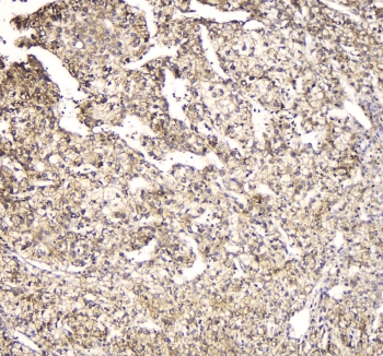 Polyclonal Rabbit anti-Human FAM176A / TMEM166 Antibody (IHC, WB)