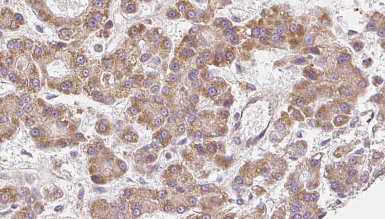 Polyclonal Rabbit anti-Human CACNA1G / Cav3.1 Antibody (IHC, WB)