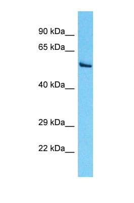 PDIA5 / PDIR Antibody (aa76-125)