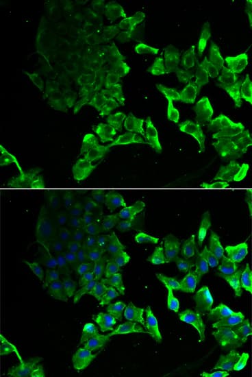 SCYL1 / NTKL Antibody