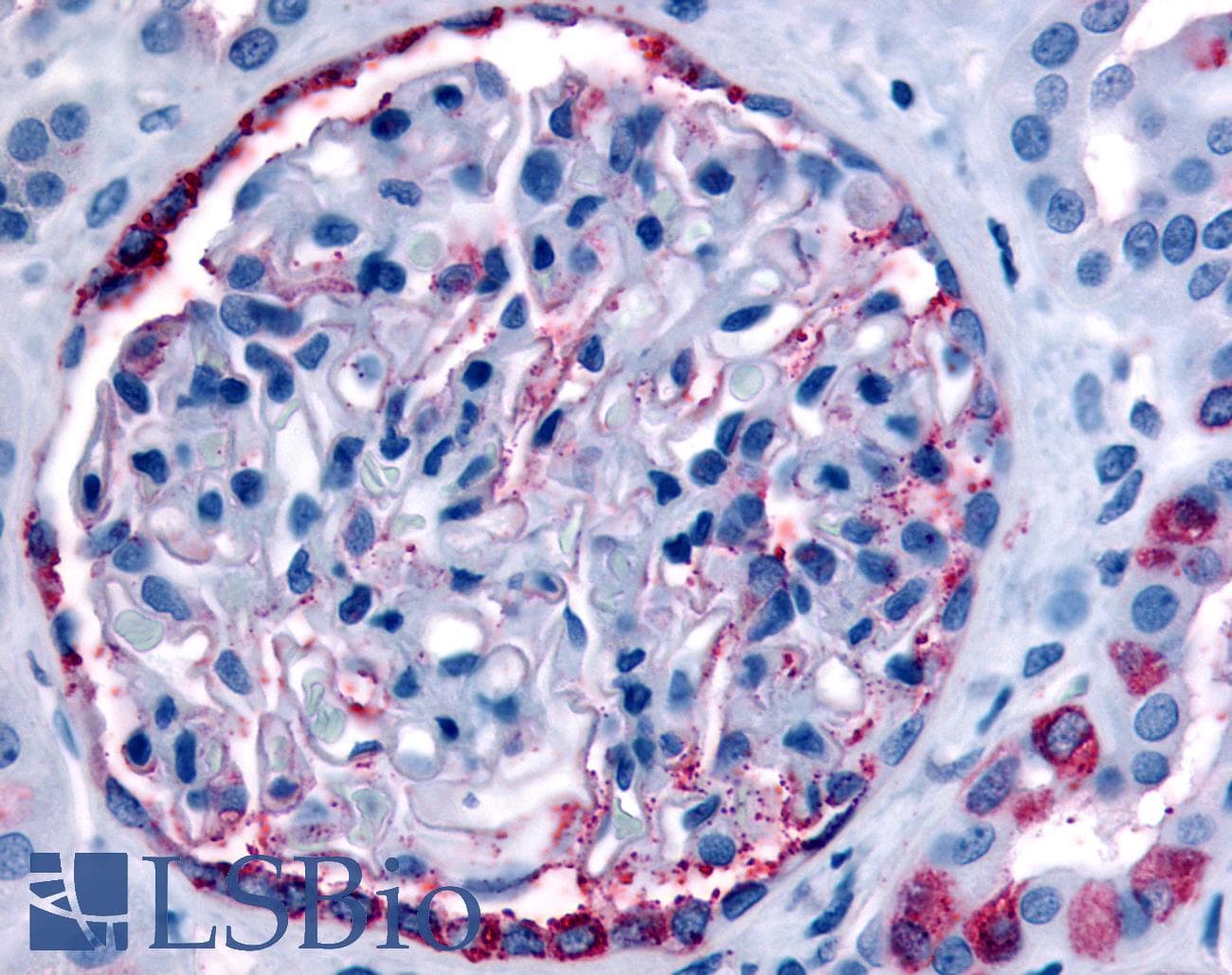 IHC-plus™ INPP5J / PIB5PA Antibody (Internal)