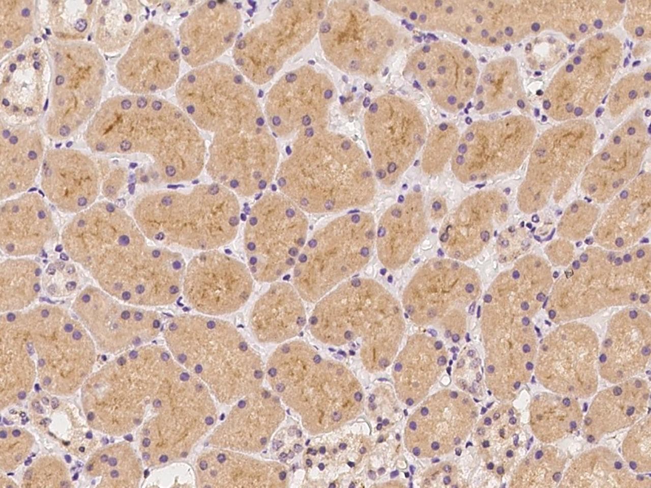 HSPA5 / GRP78 / BiP Antibody