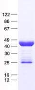 Human AKAP7 Protein (Recombinant His, N-Terminal)
