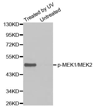 Polyclonal Rabbit anti-Human MEK1 + MEK2 Antibody (phospho-Ser217/221, IHC, WB)