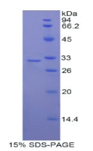 Rat MYO1C Protein (Recombinant His)