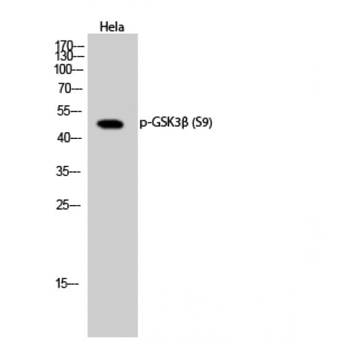 Polyclonal Rabbit anti-Human GSK3B / GSK3 Beta Antibody (1-80 aa, IHC, WB)