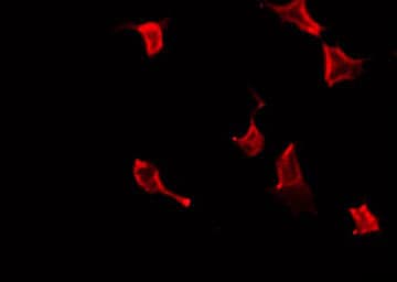 Polyclonal Rabbit anti-Human Vimentin Antibody (phospho-Ser56, IHC, IF, WB)
