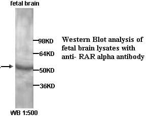 RARA / RAR Alpha Antibody (C-Terminus)