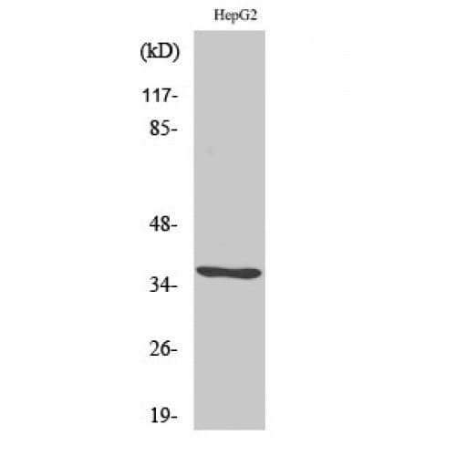 CA6 / Carbonic Anhydrase 6 Antibody (200-280 aa, C-terminal)