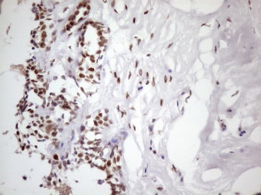 TP53BP1 / 53BP1 Antibody (aa1-300, clone OTI2H6)