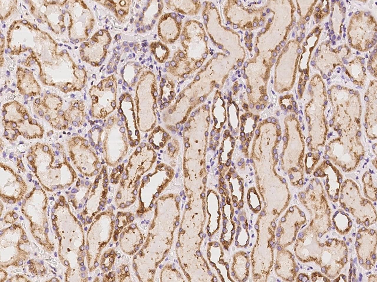 Polyclonal Rabbit anti-Human DNAH8 Antibody (IHC)