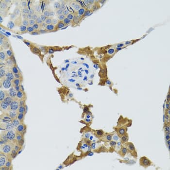 IHC-plus™ Polyclonal Rabbit anti-Human PLA2G2D Antibody (IHC, IF, WB)