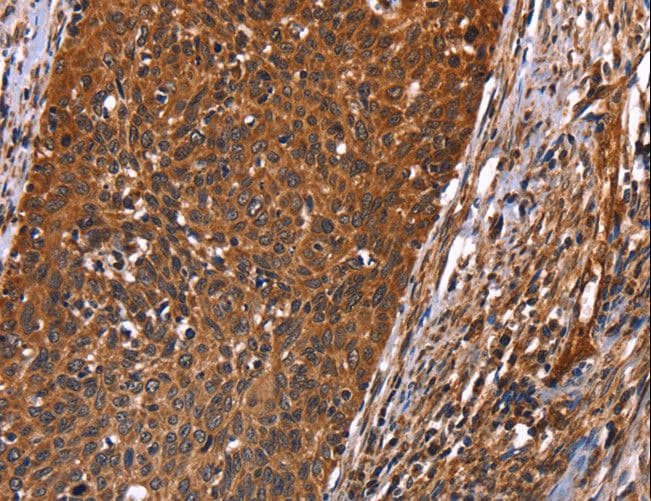 GUK1 / Guanylate Kinase 1 Antibody