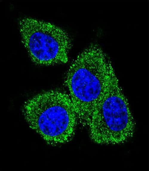 PIP / GCDFP-15 Antibody (aa77-106)