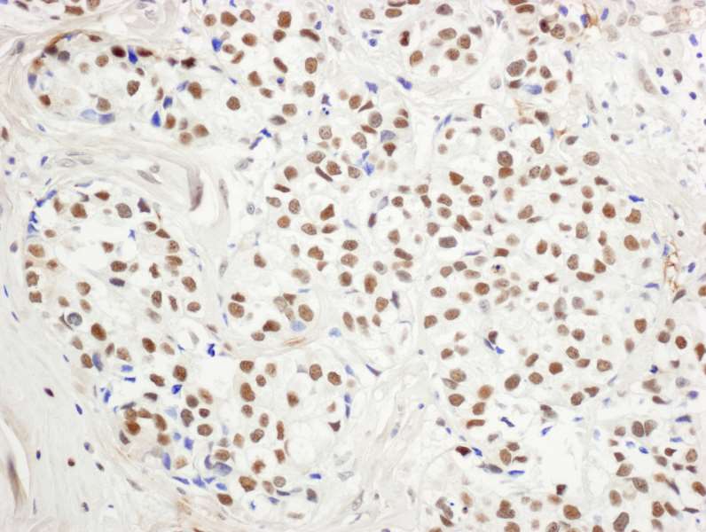 KDM1A / LSD1 Antibody (aa50-100)
