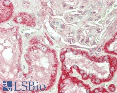 IHC-plus™ MTX1 / Metaxin 1 Antibody