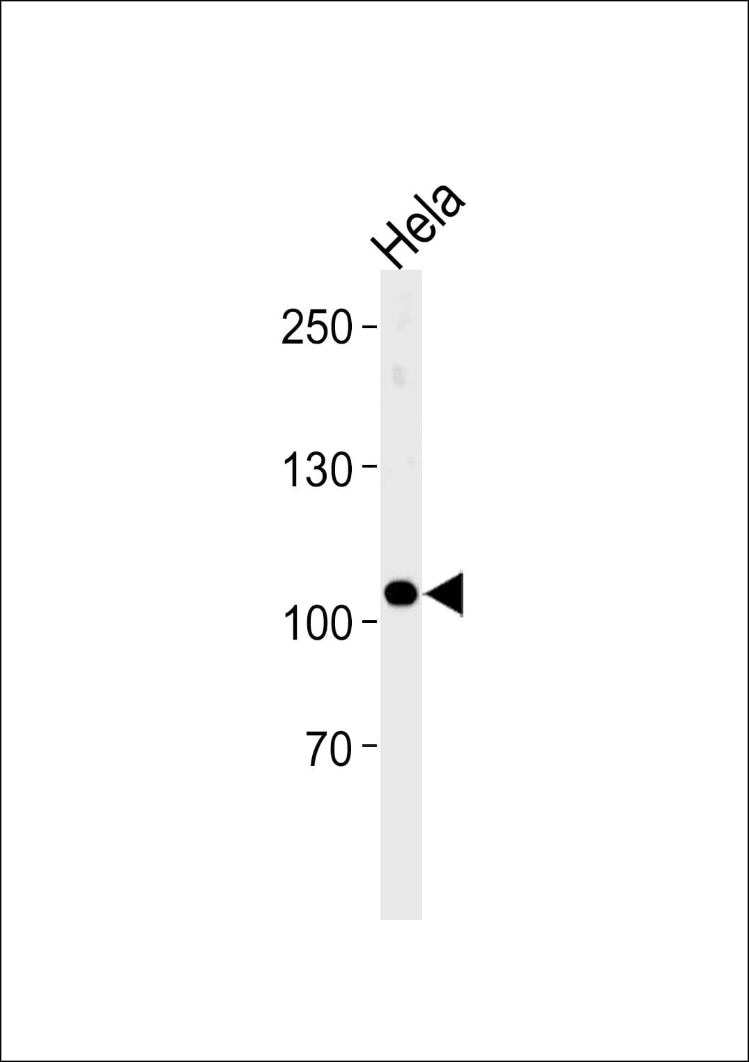 UBE3C Antibody (aa549-578)