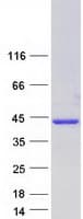 Human HNRNP-E2 / PCBP2 Protein (Recombinant Myc-DDK (Flag))