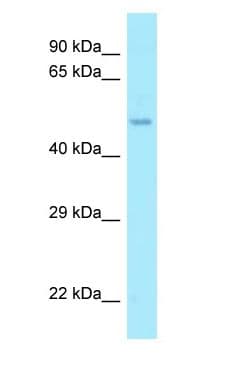 AAMP Antibody (aa158-207)