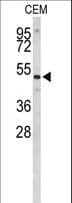CNDP1 Antibody (aa415-443)