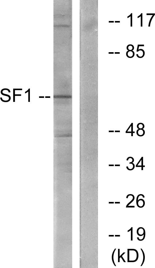 IHC-plus™ SF1 Antibody (aa48-97)