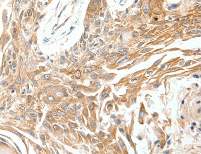 Polyclonal Rabbit anti-Human SCN11A / Nav1.9 Antibody (IHC)