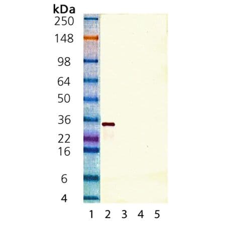 SIRT5 / Sirtuin 5 Antibody