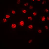 IHC-plus™ HOXA1 Antibody (Internal)
