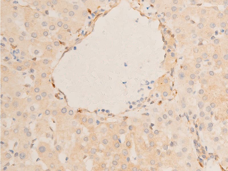 HSPB6 / HSP20 Antibody (phospho-Ser16)