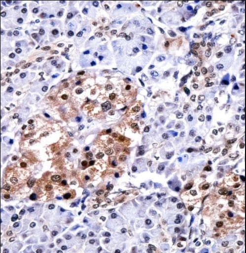 CELF1 / CUGBP1 Antibody (aa1-30)