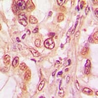 TP53 / p53 Antibody (phospho-Thr81)