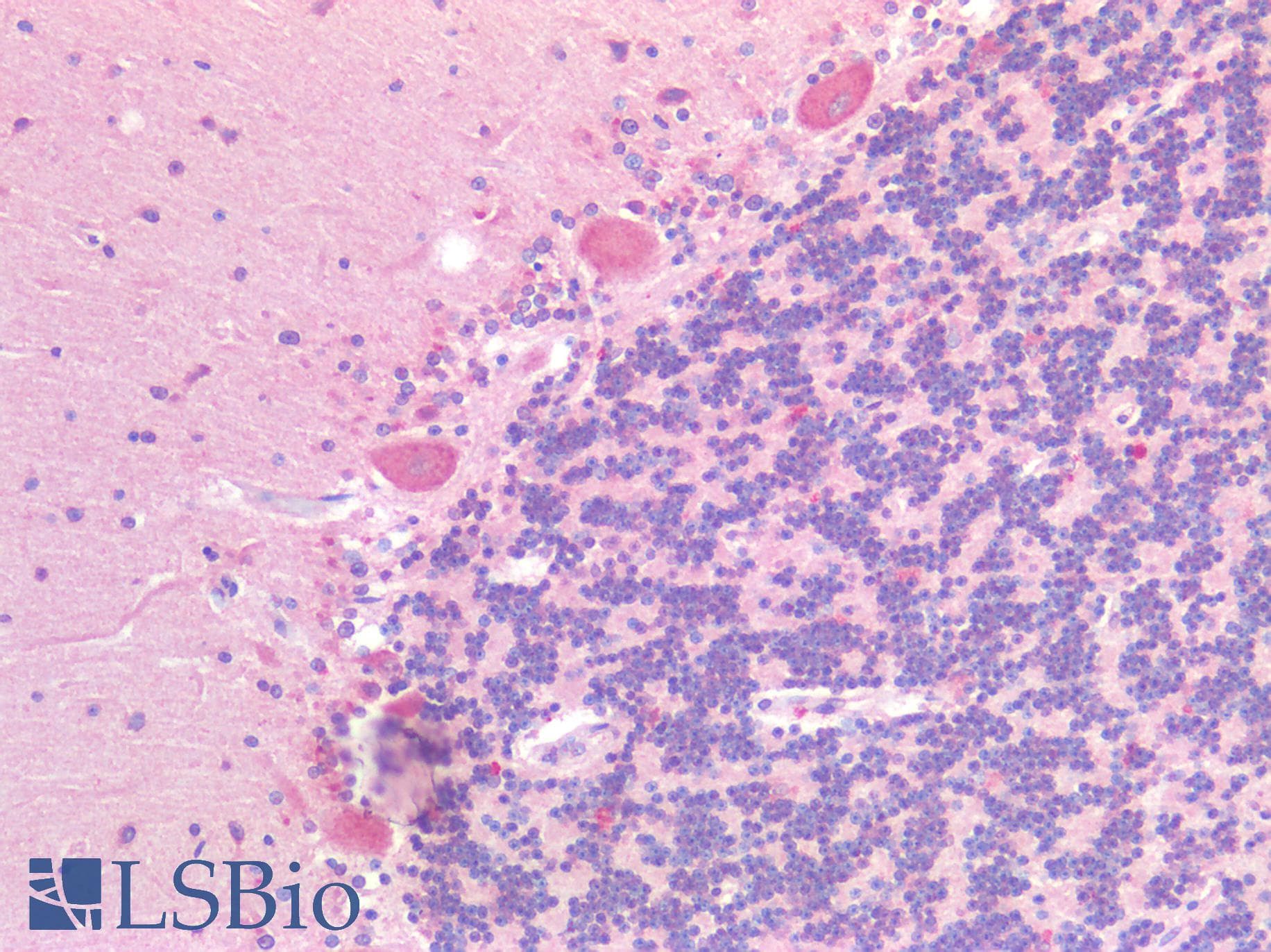 PathPlus™ GPR87 Antibody (N-Terminus)