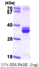 Human NUDT5 Protein (Recombinant His)