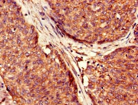 Polyclonal Rabbit anti-Human USP6 / HRP1 Antibody (IHC, IF, WB)