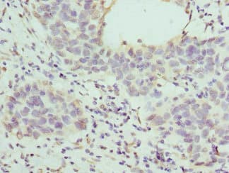 Polyclonal Rabbit anti-Human HAPLN1 Antibody (IHC)