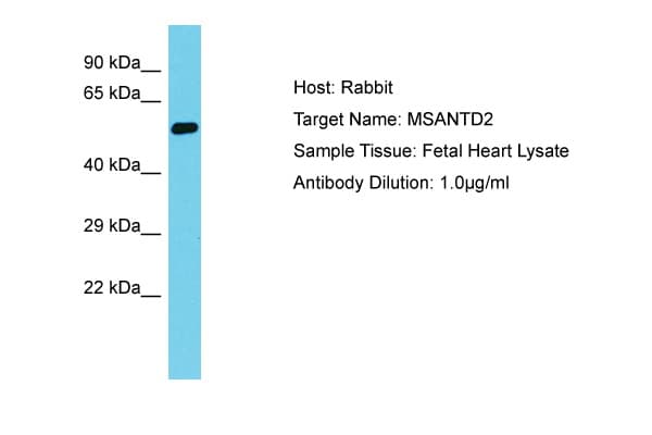 MSANTD2 / C11orf61 Antibody (aa153-202)