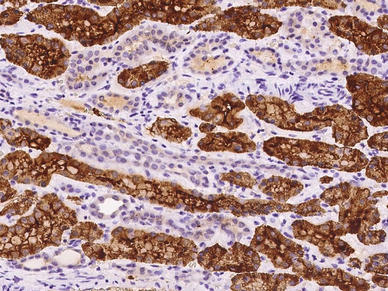 NHLH2 / HEN2 Antibody
