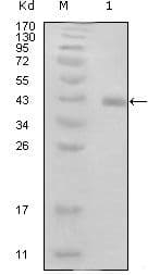 HPV E7 Antibody (clone 3D6F1)