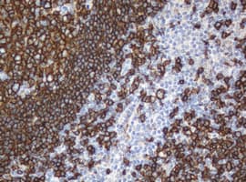 CD20 Antibody (clone OTI2D3, Carrier-free)