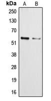 CYP3A4+5 Antibody (Internal)