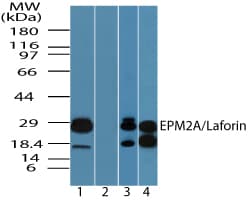 IHC-plus™ Polyclonal Rabbit anti-Human EPM2A / Laforin Antibody (aa80-130, IHC, WB)
