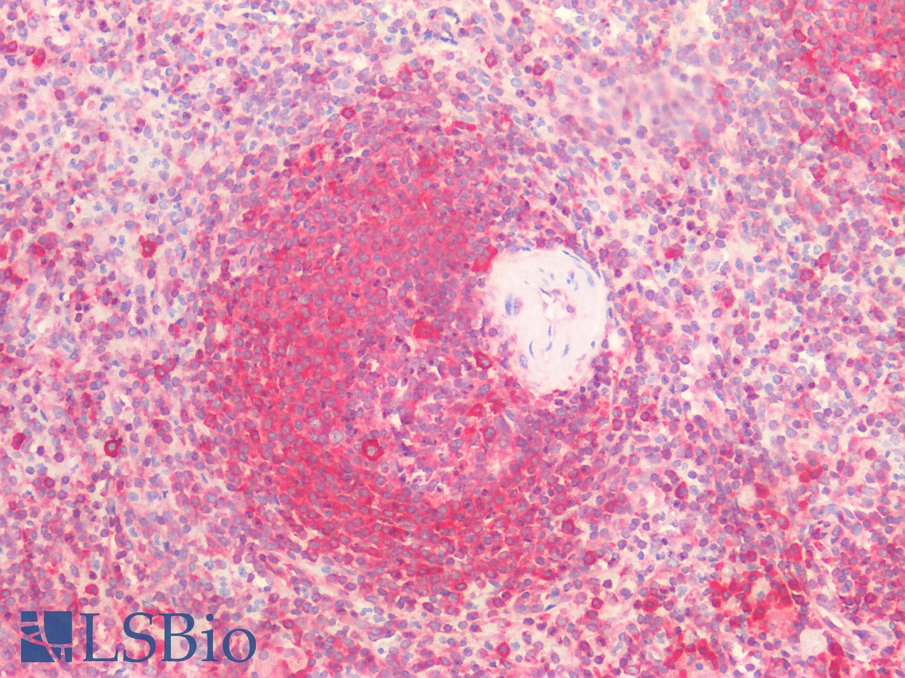 PathPlus™ CTSV / Cathepsin V Antibody (Internal)