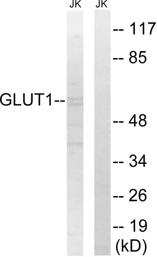 IHC-plus™ SLC2A1 / GLUT-1 Antibody (aa441-490)