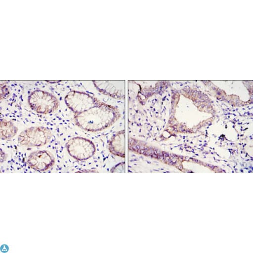CDH1 / E Cadherin Antibody