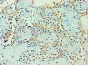 ZNF346 Antibody (aa1-294)