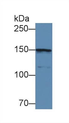COL4A5 / Collagen IV Alpha5 Antibody (aa1461-1685)