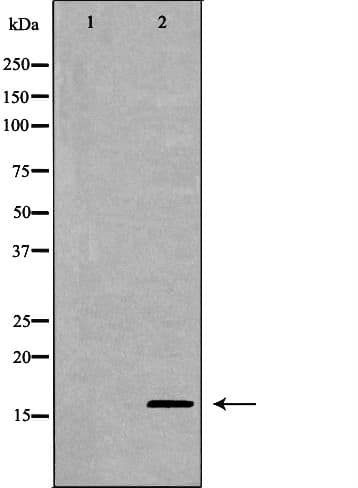 MDK / Midkine Antibody