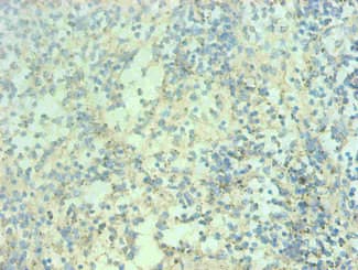 Monoclonal Mouse anti-Human S100A9 / MRP14 Antibody (clone 1G1C1, IHC)