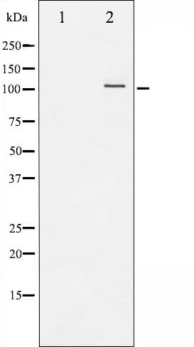 NFKB1 / NF-Kappa-B Antibody (phospho-Ser907)