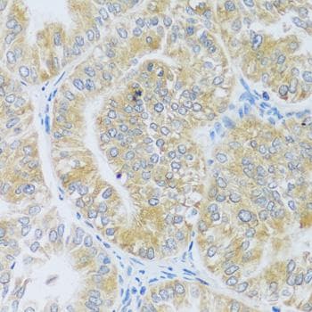 ASB4 Antibody